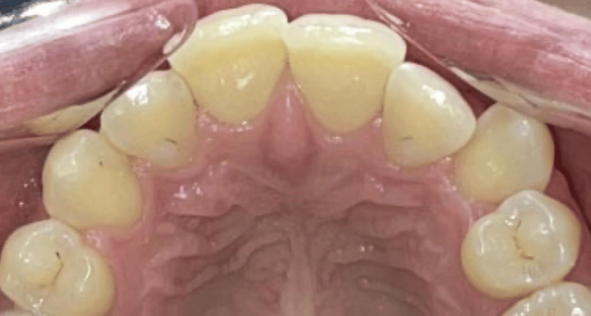 Before - Rothwell Dental