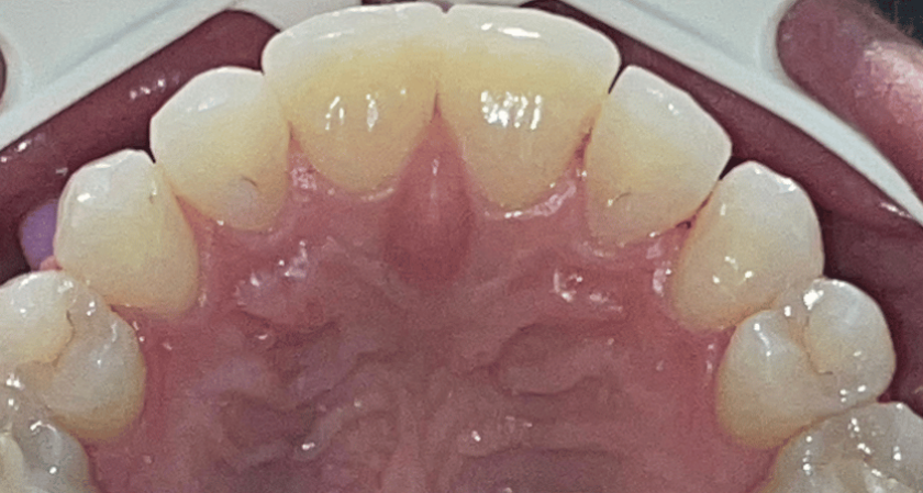 After -Rothwell Dental