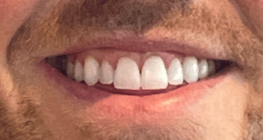After -Rothwell Dental