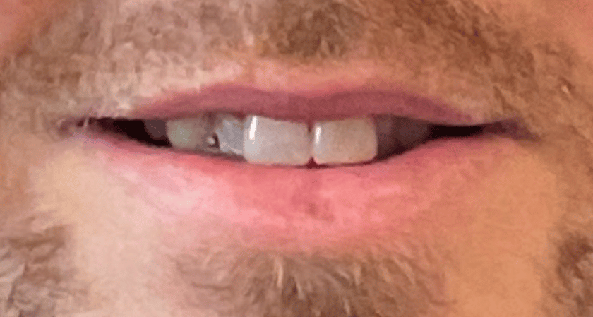 Before - Rothwell Dental