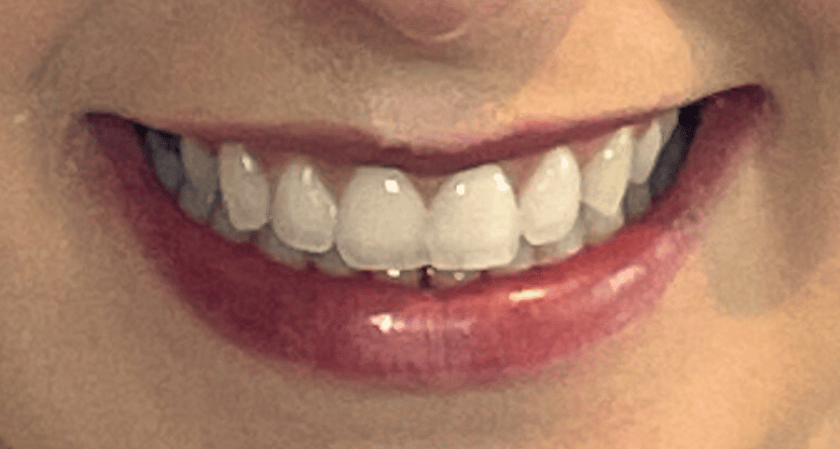 After -Rothwell Dental