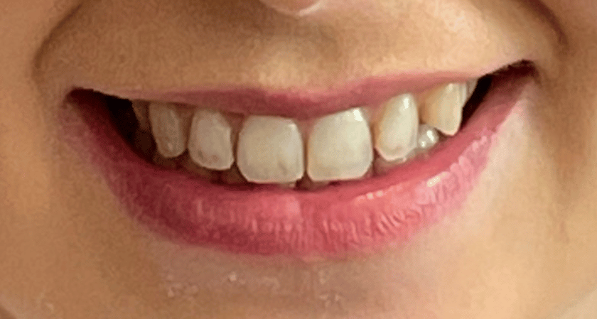 Before - Rothwell Dental