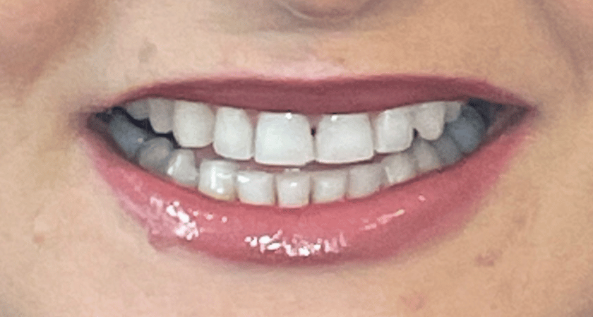 After -Rothwell Dental