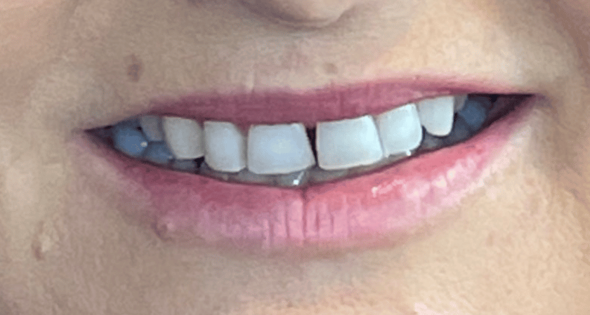 Before - Rothwell Dental