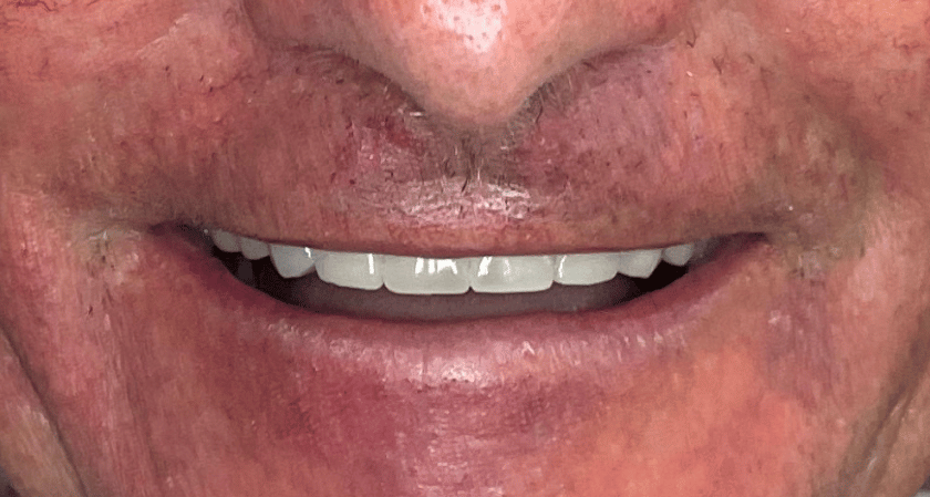 After -Rothwell Dental