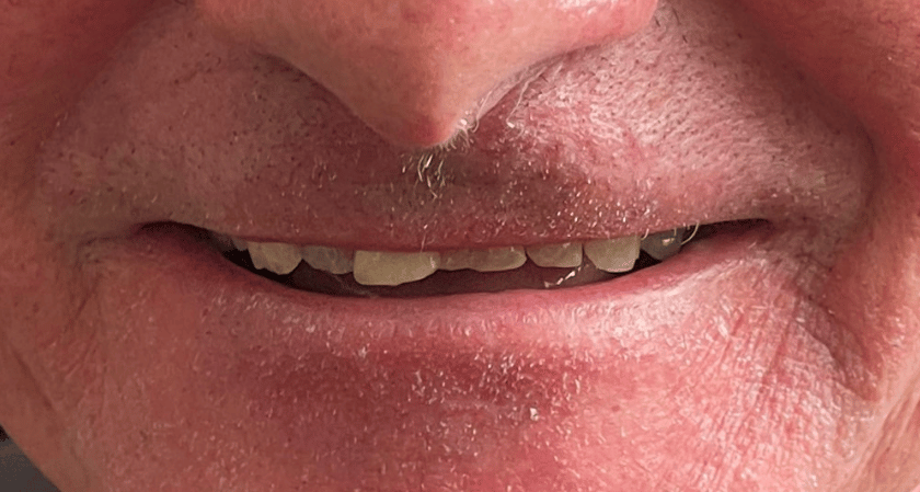 Before - Rothwell Dental