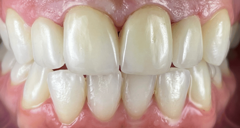 After -Rothwell Dental