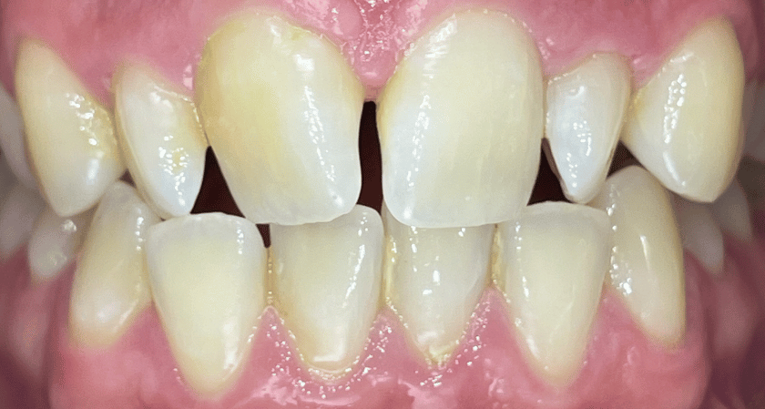 Before - Rothwell Dental