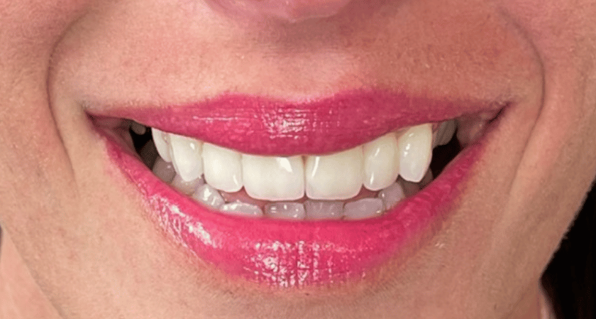 After -Rothwell Dental