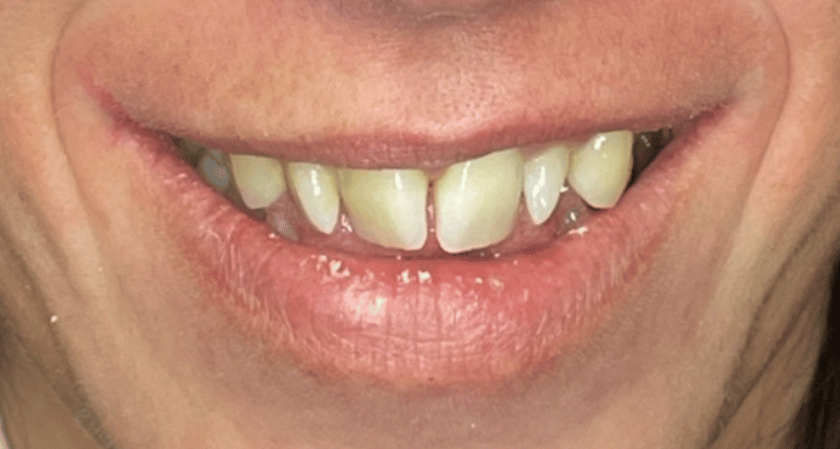 Before - Rothwell Dental