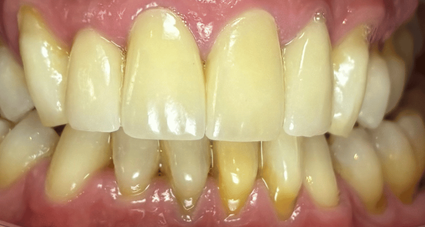 After -Rothwell Dental