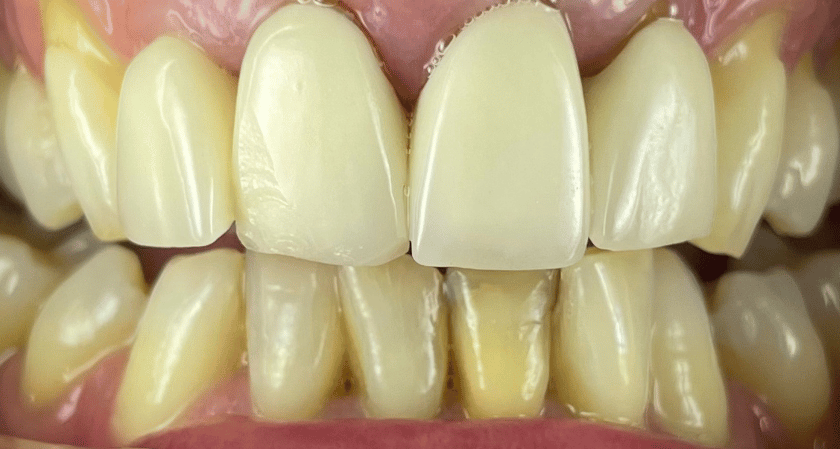 Before - Rothwell Dental