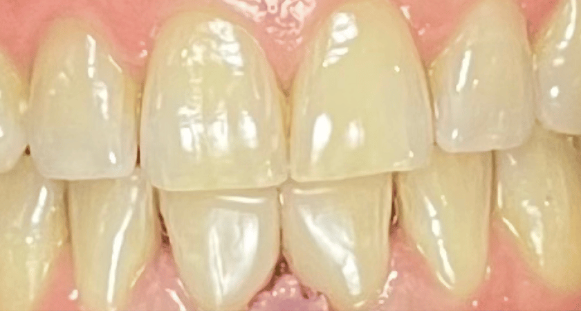 After -Rothwell Dental