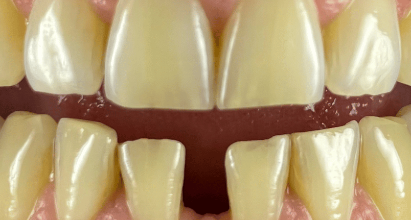 Before - Rothwell Dental