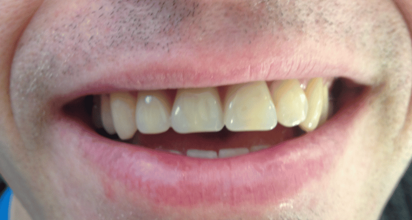 After -Rothwell Dental