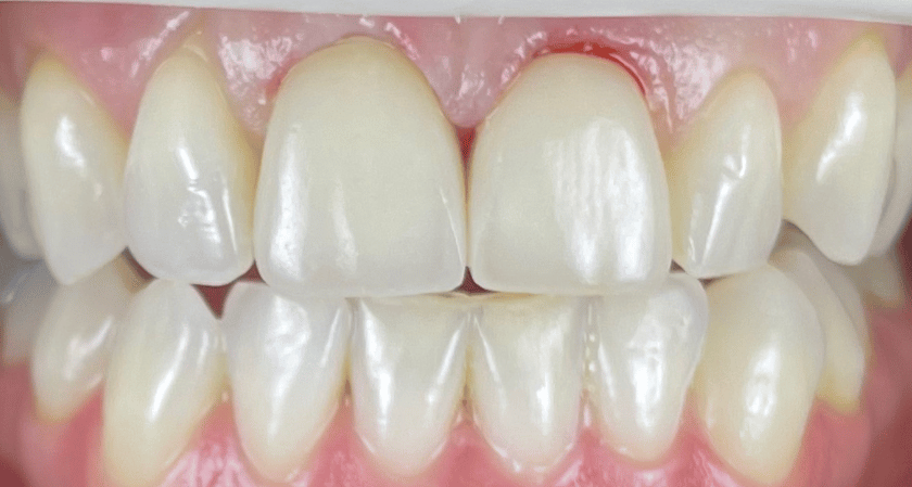 After -Rothwell Dental