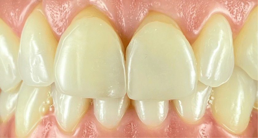 Before - Rothwell Dental