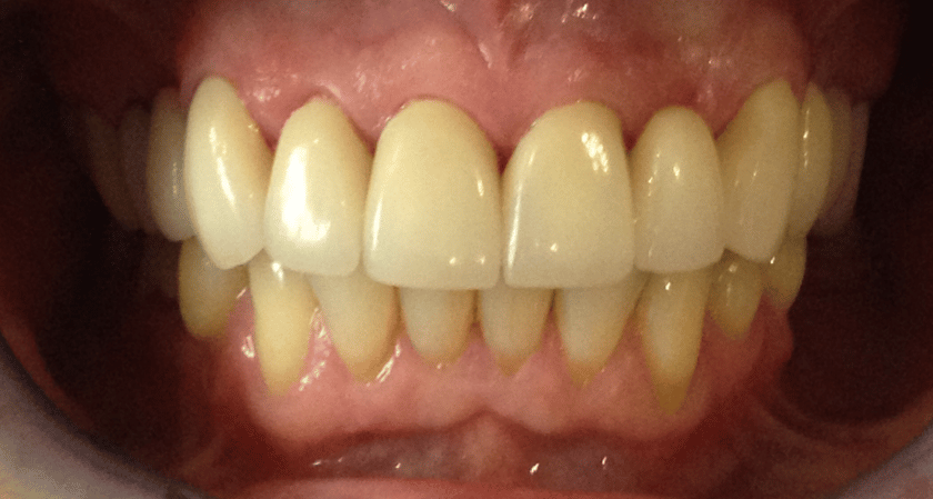 After -Rothwell Dental