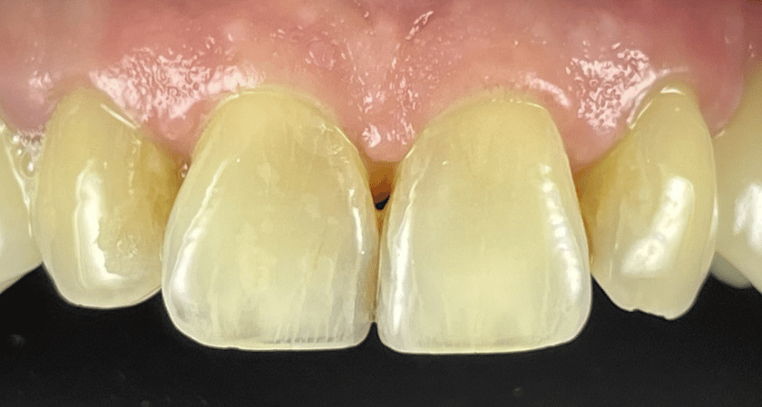 After -Rothwell Dental