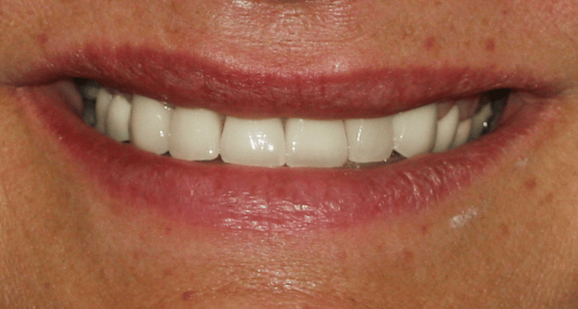 After -Rothwell Dental