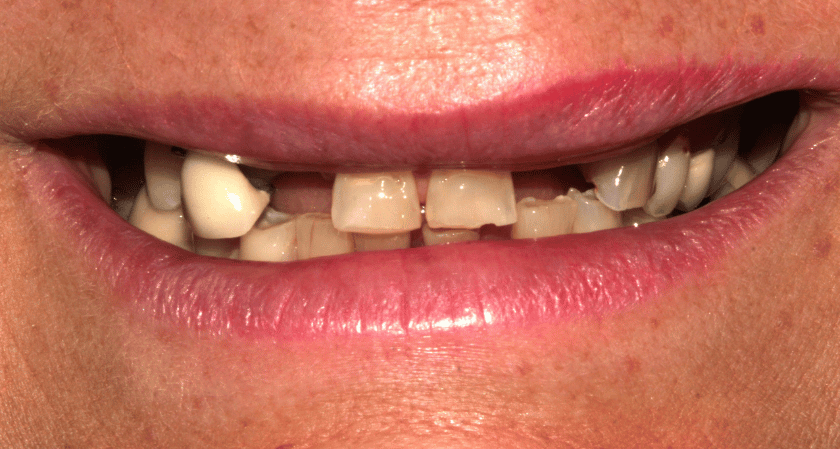 Before - Rothwell Dental