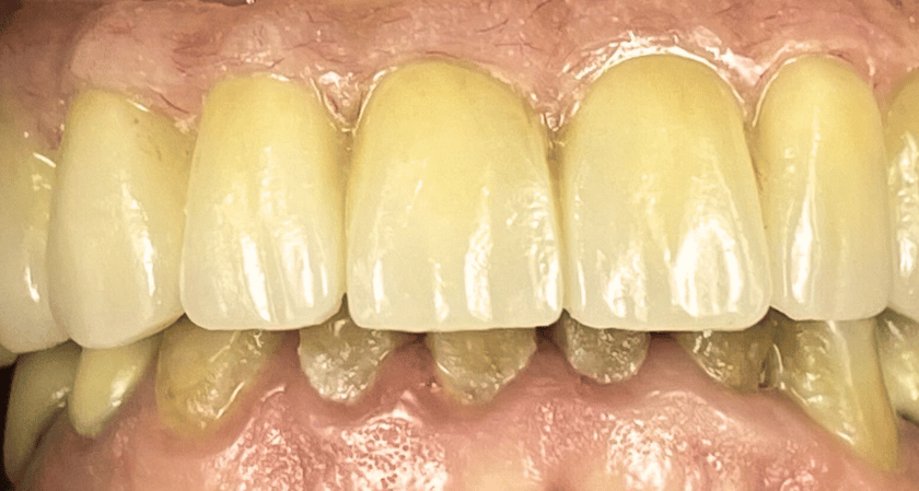 After -Rothwell Dental