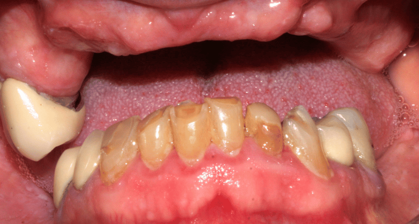 Before - Rothwell Dental