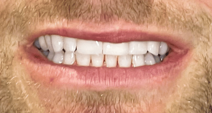 After -Rothwell Dental