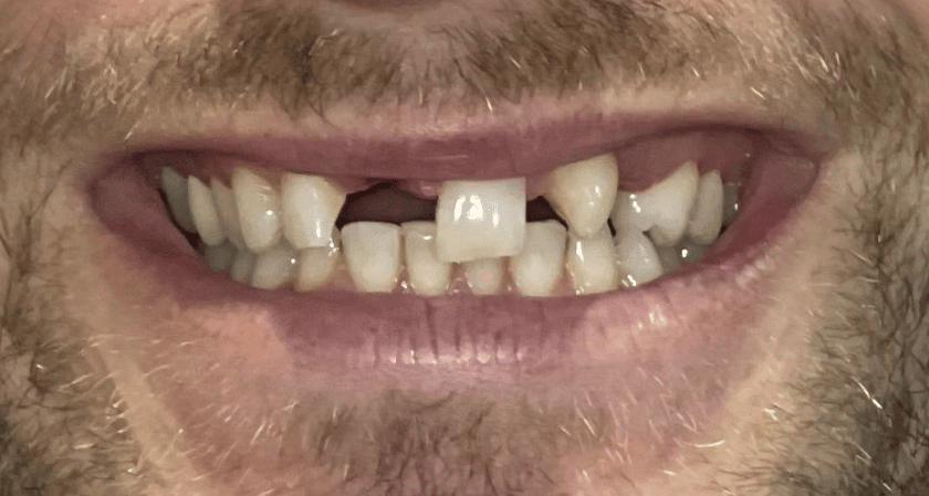 Before - Rothwell Dental
