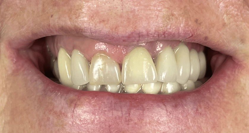 After -Rothwell Dental