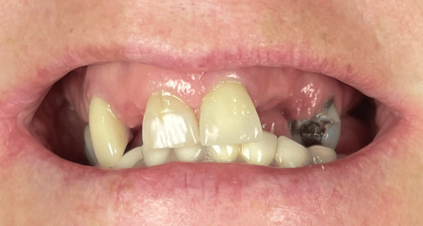 Before - Rothwell Dental