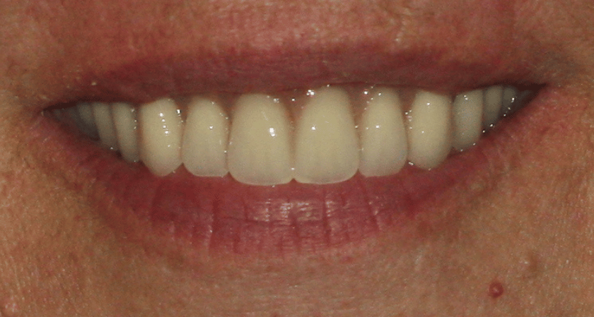 After -Rothwell Dental