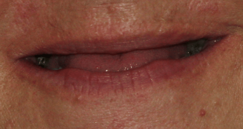 Before - Rothwell Dental