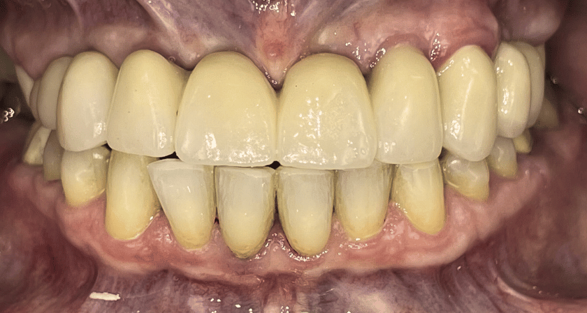 After -Rothwell Dental