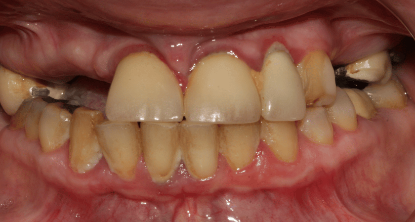 Before - Rothwell Dental