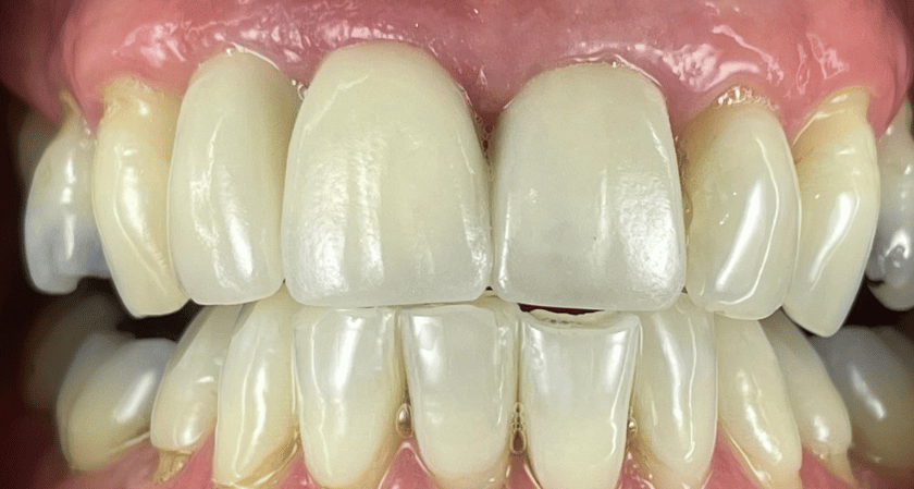 After -Rothwell Dental