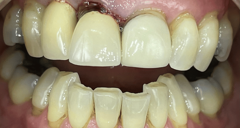 Before - Rothwell Dental