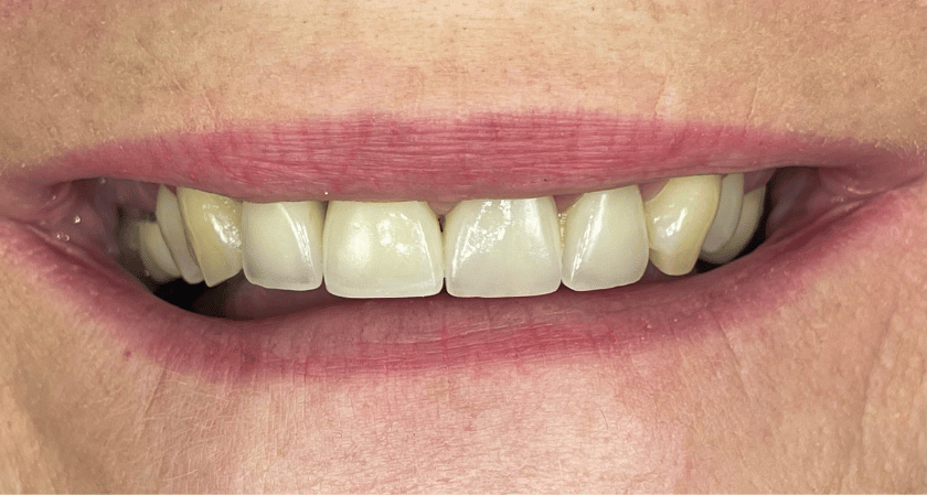 After -Rothwell Dental