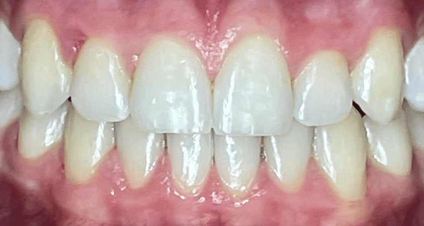 After -Rothwell Dental