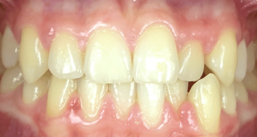 Before - Rothwell Dental