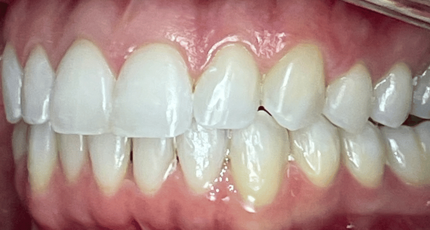 After -Rothwell Dental