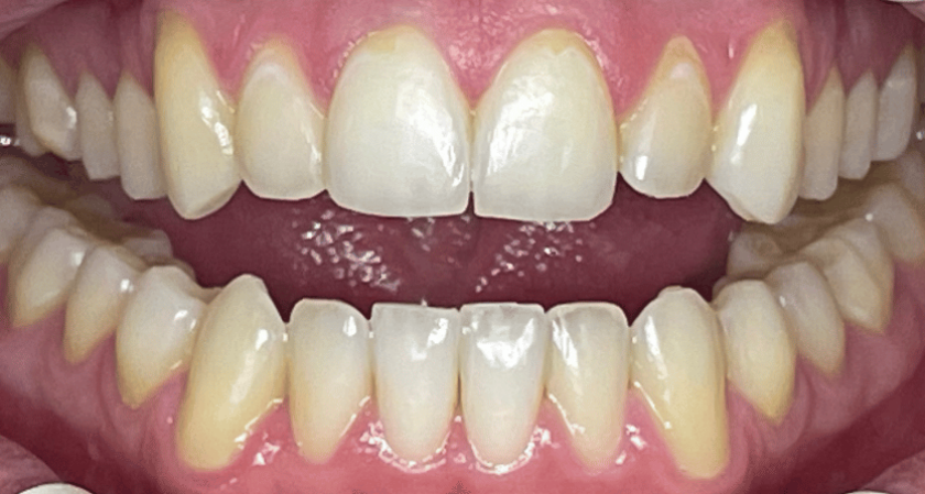 After -Rothwell Dental