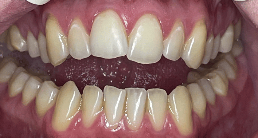 Before - Rothwell Dental