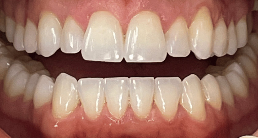 After -Rothwell Dental