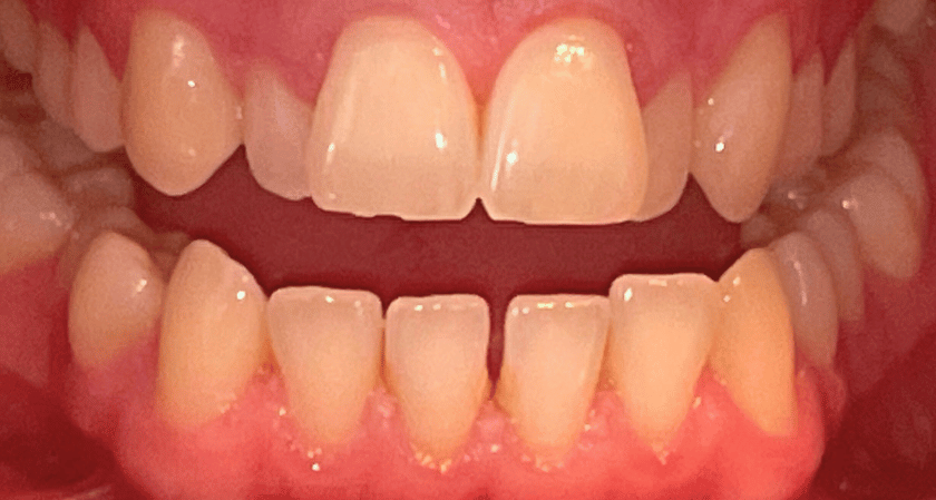 Before - Rothwell Dental