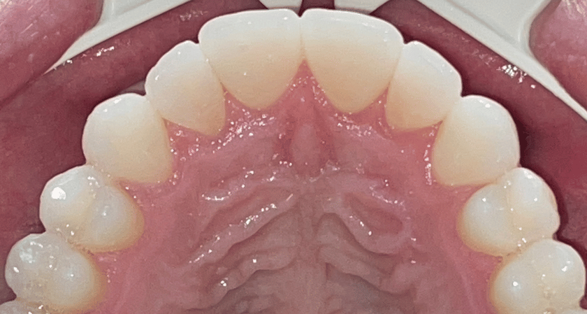 After -Rothwell Dental