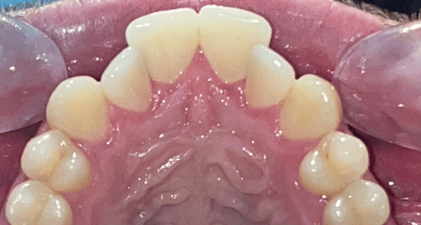 Before - Rothwell Dental