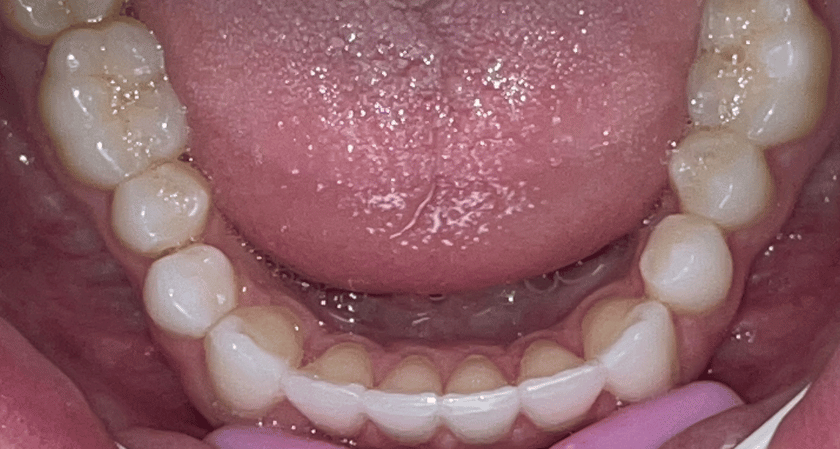 After -Rothwell Dental