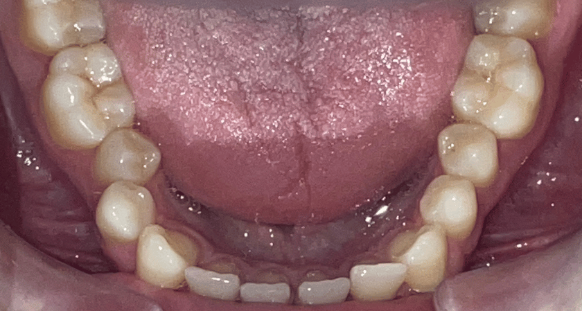 Before - Rothwell Dental