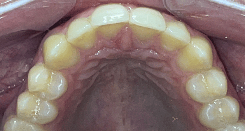 After -Rothwell Dental